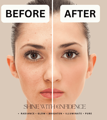 Whitening Cream for Women & Men