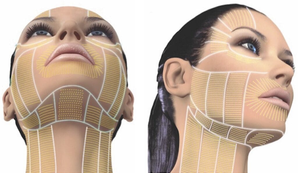 Neck-Contouring