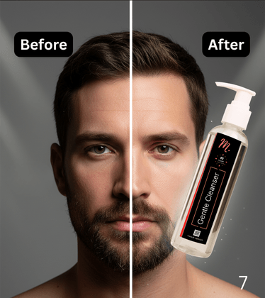 M. Gentle Cleanser – Mild, Hydrating & Deep Cleansing Formula